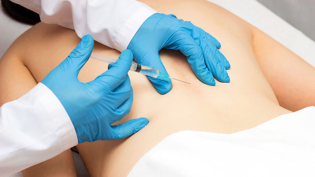 Botox nie tylko na zmarszczki tajemnicza bron w walce z bolem kat