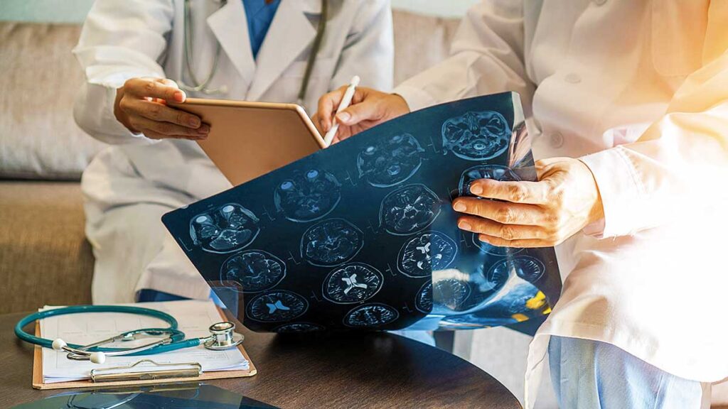 Dalekosiezne skutki urazow mozgu perspektywa epidemiologiczna i dlugotrwale konsekwencje kat