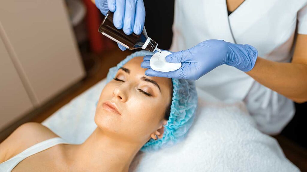 Deep chemical peeling truly amazing experience kat