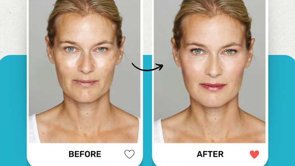 Ipl treatment at euro skynn lab in new york anna glowacki dnp kat