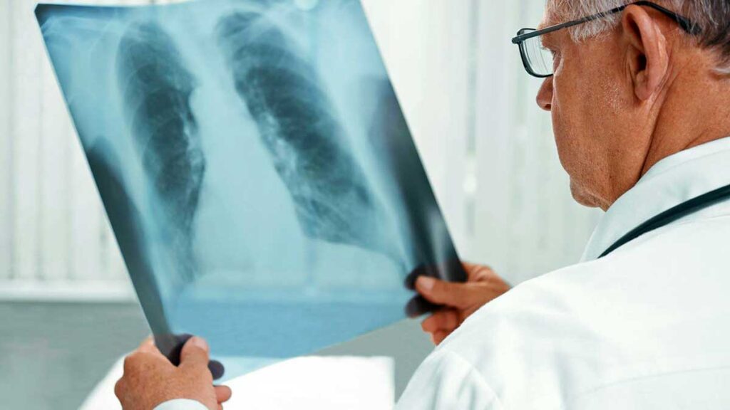 Mec kaminski o poszkodowanych polakach w strefie wtc nyc mozna skladac wnioski o odszkodowanie do 2090 cz 2 kat