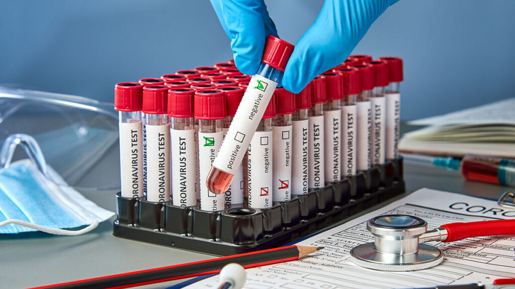 Nowe zalecenia cdc dotyczace kwarantanny i izolacji dla osob zakazonych covid 19 kat