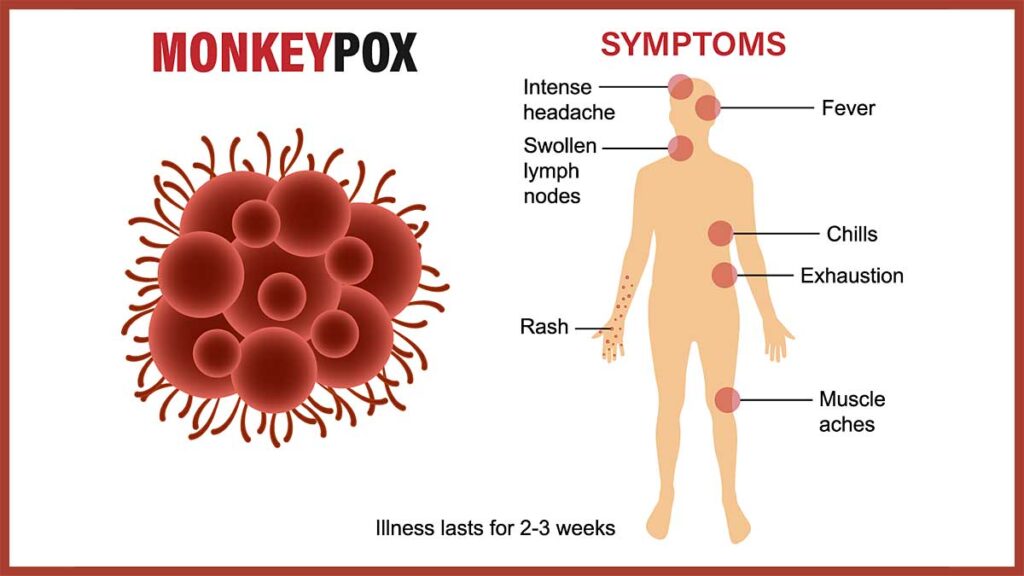 Nowy jork wprowadza serwis powiadomien sms em o malpiej ospie kat