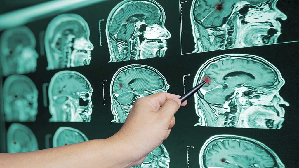 Po kazdym wypadku natychmiast odwiedz lekarza z serii na wszelki wypadek czesc 6 kat