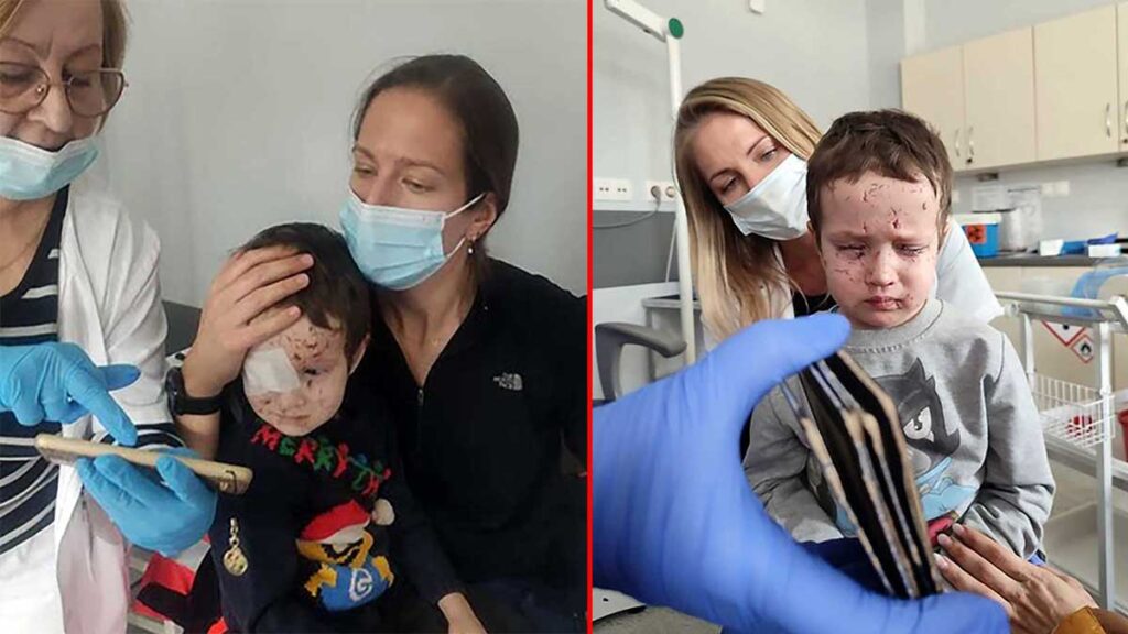 Polscy medycy ewakuuja rannych z ukrainy kazdy konwoj to historia ludzkich tragedii kat