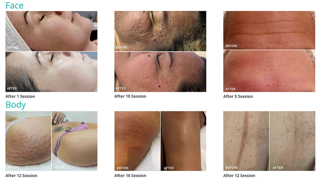 Polski gabinet kosmetyczny w nowym jorku shineagain beauty clinique zaprasza na bloomea najlepszy zabieg regenerujacy skore kat