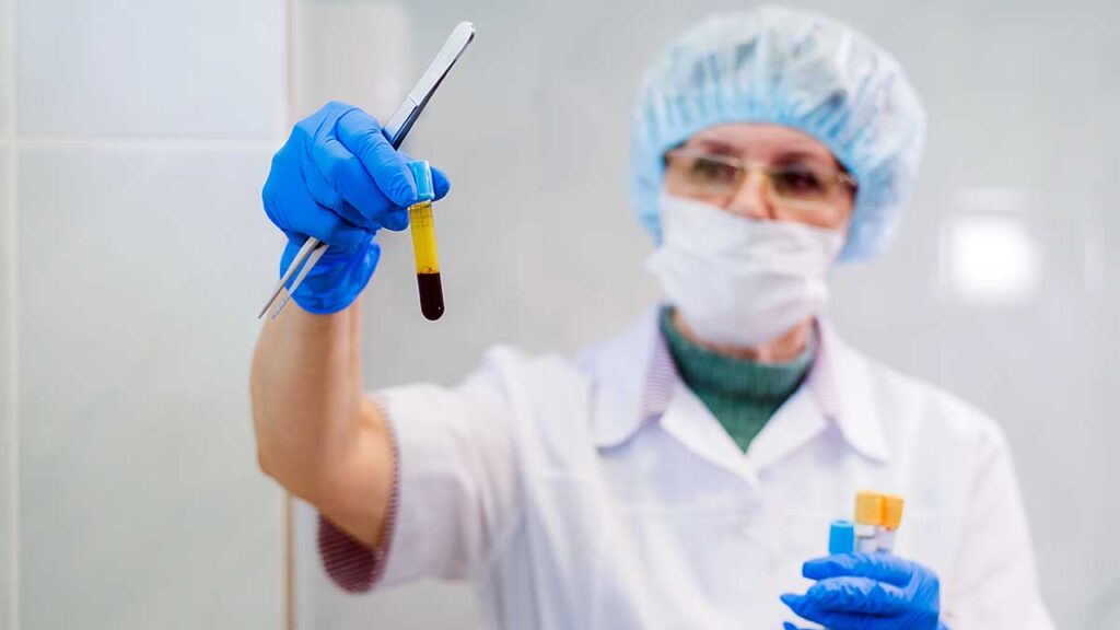 Prp therapy safe and effective treatment for regeneration of tissues in the body kat