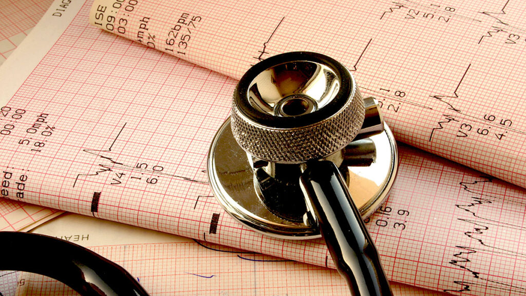 The basics of heart rhythm disorders understanding your hearts electrical system kat