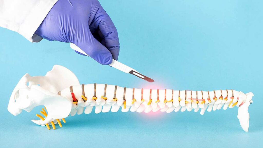 The promise of minimally invasive spine surgery miss kat