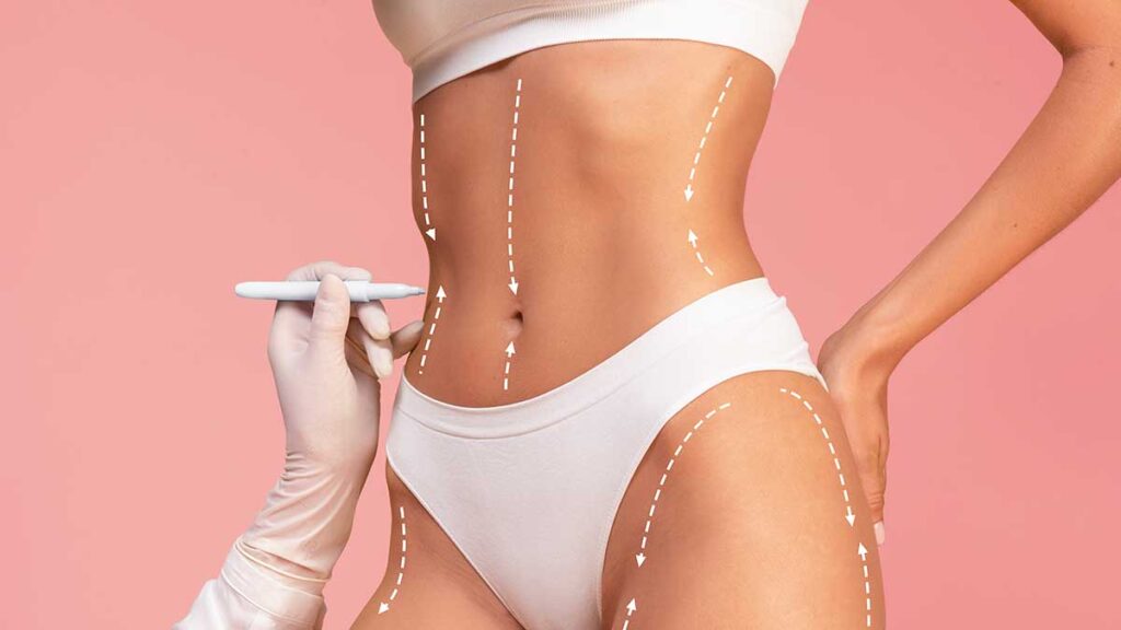 Znizka na zabiegi chirurgii plastycznej w new jersey chirurg plastyczny robert fischer oferuje 30 znizki kat