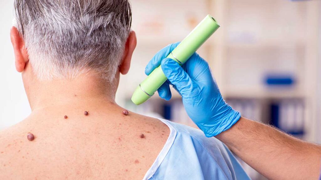 Dermatolog na greenpoincie i manhattanie w park plaza dermatology mowimy po polsku kat