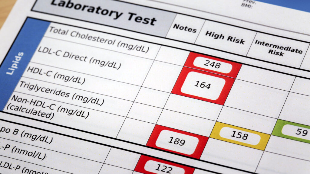 Your cholesterol might look normal but read this kat