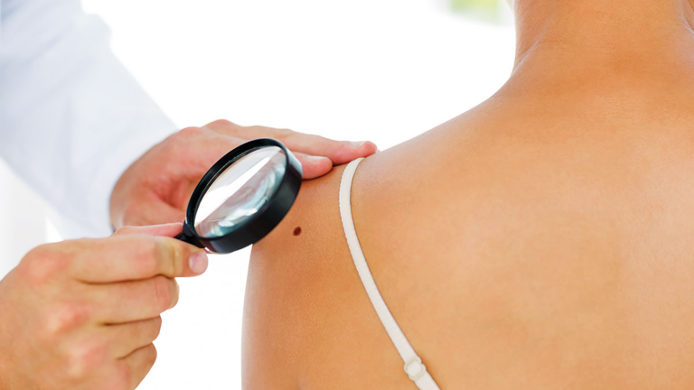 Leczenie chorob dermatologicznych w nowym jorku na greenpoincie i manhattanie w park plaza dermatology mowimy po polsku